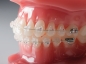 Preview: G4™ Tooth-Coloured, Nickel titanium superelastic (SE), Natural Form, RECTANGULAR