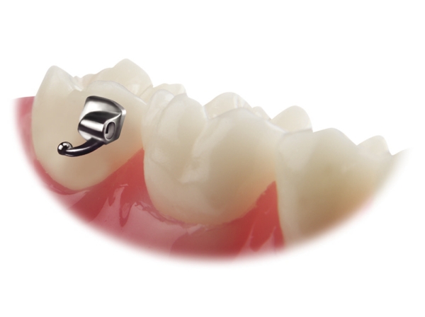 VIPER™, Bondable buccal tube, Mini (tooth 17), .018", Torque -10°, Offset 0°